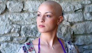 woman-who-lost-hair-due-to-cancer-treatment